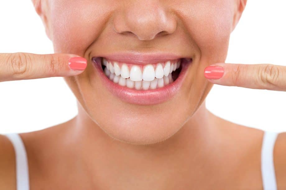 3 Options for Whitening Your Teeth