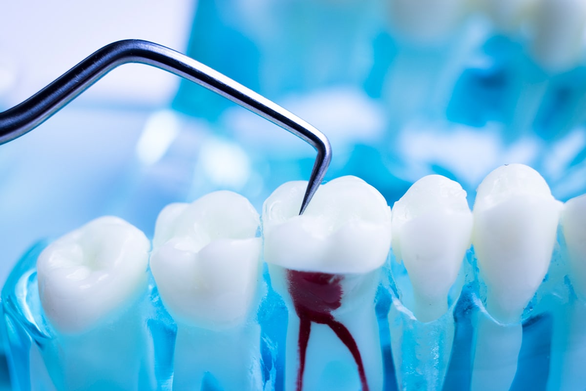 General Dentistry Decorative Image