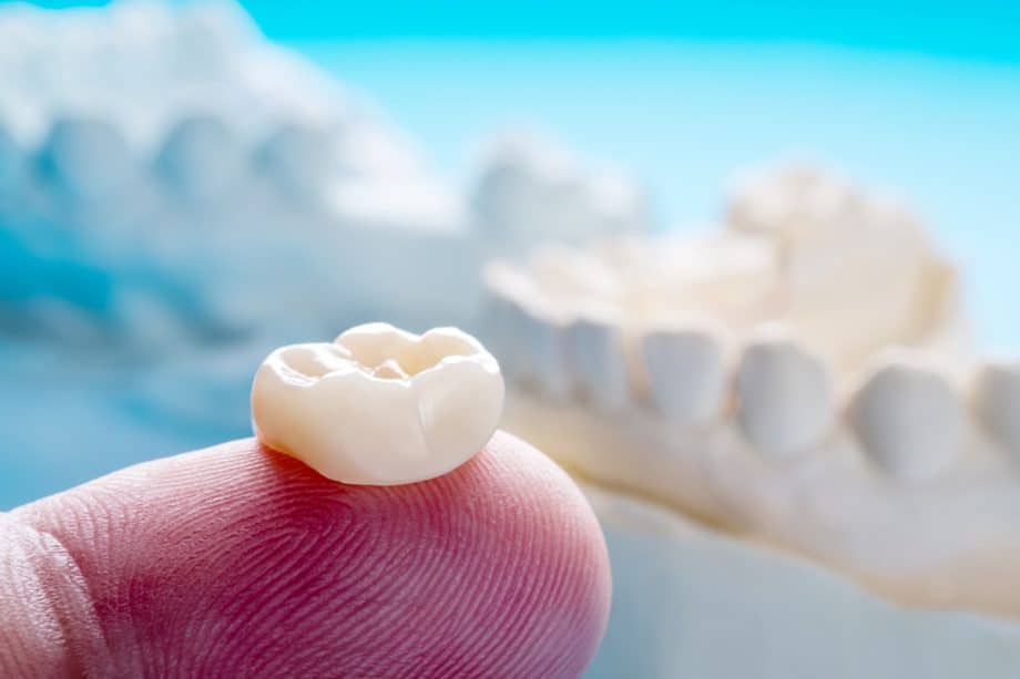 Dental Fillings vs. Crowns: Which Is the Better Option?