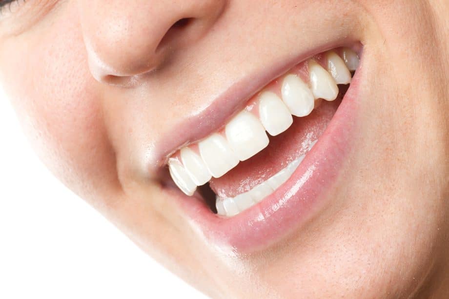 How Do Veneers Work?